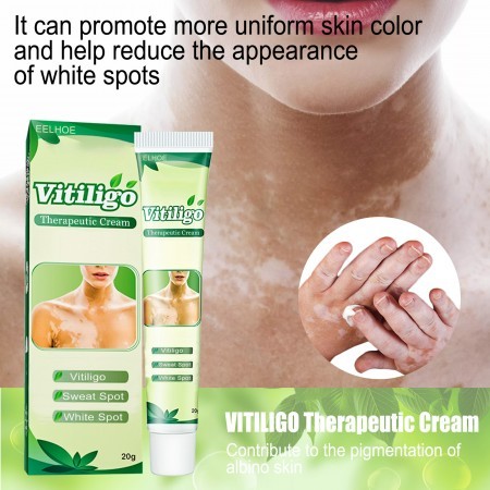 Vitiligo Therapeutic Cream - Image 2